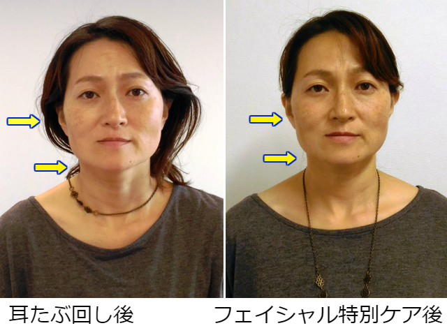 facial-tokubetsu1